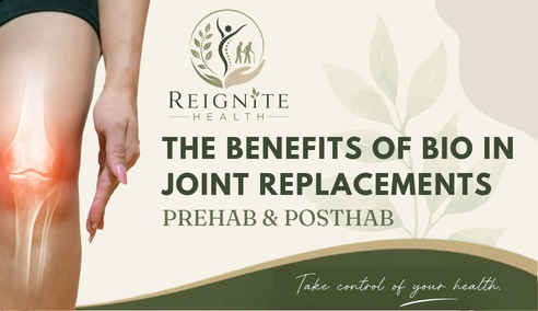 The Benefits of Biokinetics for Joint Replacements: Why Prehabilitation and Post-Rehabilitation Matter